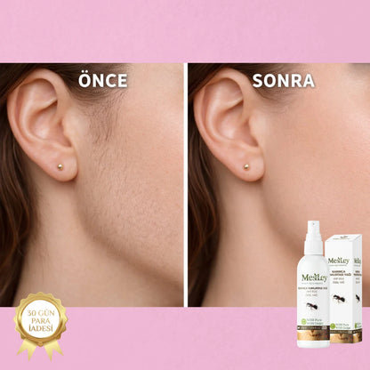 MesLey Naturals Karınca Yumurtası Yağı - İstenmeyen Tüylerle Vedalaşın!