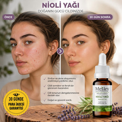Mesley Naturals %100 Doğal Nioli Yağı – hijyen ve bakım serumu